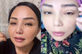 «Жіппен тігіп берді»: Алтынай Жорабаева ота жасатқанын айтты