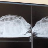 Дәрігерлер британдық қыздың қынабынан тасбақа алып шықты