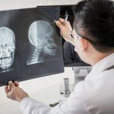 Дәрігерлер бетін плита жаралаған астаналық қыздың жағдайы жайлы айтты