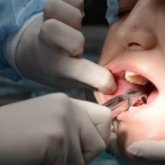 Ақтөбе тұрғыны ақыл тісін жұлдырамын деп өліп қала жаздаған