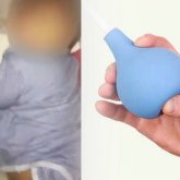 Шымкентте клизмадан кейін күйіп қалған 1 жасар бала Алматыға жеткізілді