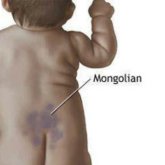 «Тәңір таңбасы»: қазақтар «қал» деп жүрген сәбидің денесіндегі белгінің сыры неде?