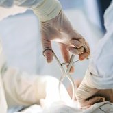 Ота кезінде жүкті әйелдің бауырынан бір уыс паразит табылды