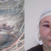 Нұр-Сұлтан көшесінде әйелді өлімші етіп тепкілеп кеткен күдікті 11 күн бойы ұсталмапты (ФОТО)