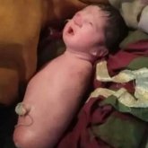 Екі аяғы, екі қолы жоқ сәби дүниеге келді