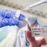 Елімізде ПТР тест бағасы арзандады