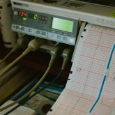 Жүрек ұстамасының басқа да симптомдары анықталды