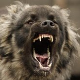 Өз иті қауып алған әйел қолсыз қалды: туыстары дәрігерлердің үстінен шағымдануда