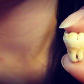 Әйел тіс дәрігерінің бөлмесіне кіріп, науқастың 13 тісін жұлып алды