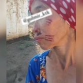 Түркістан облысында қайынәпкесі келіннің бетін қызып тұрған шанышқымен күйдірген