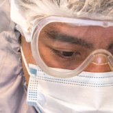 Тағы бір елден маймыл шешек вирусы анықталды