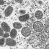 Ұлыбританияда маймыл шешегіне қарсы дәрі табылды