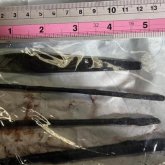 Ақтау дәрігерлері науқас асқазанынан 15-18 см болатын бірнеше темір алып шыққан