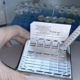 Елімізге маймыл шешегін анықтауға арналған тест жеткізілді