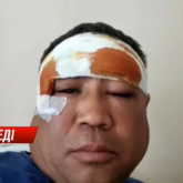 Түркістан облысында депутат кәсіпкерді соққыға жықты