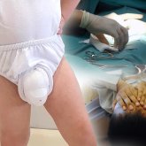 Баланы қай жаста сүндетке отырғызған дұрыс