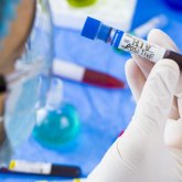 Теміртау тұрғыны екі мәрте үйленіп, екі әйеліне де АИТВ инфекциясын әдейі жұқтырған