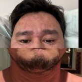 «Емін таба алмады». Актер Жахан Отарғалиев сырқаты туралы айтты