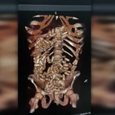 Асқазанына 2 келі апиын жасырған: ҰҚК есірткі тасымалдаған шетелдіктерді ұстады