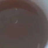 Степногор ауруханасында науқастардың тамағынан құрт шыққан