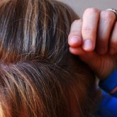 Астанада 11 жастағы қыздың ауыз қуысында шаш өскен