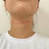 Талдықорғанда кеңсе пышағымен қызының тамағын орған жігіттің ісін алаяқтыққа ауыстырмақ