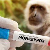 ДДСҰ маймыл шешегіне қарсы алғашқы вакцина туралы мәлімдеме жасады