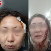 «Берілсең ештеңе болмайды»: Ақмола облысында әйел адам белгісіз біреуден оңбай таяқ жеген (ВИДЕО)