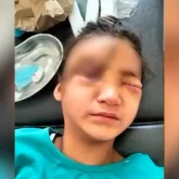 «Бетінің тең жартысы тігілген»: Ақтауда 12 жастағы қыздың басына футбол қақпасы құлаған