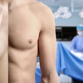 Қазақстанда жыныс ауыстыру операциялары тіркелмеген - Үкімет