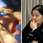 «Ұйқымнан тұрсам, имплант түсіп қалған»: Алматылықтар лицензиясы жоқ дәрігерден зардап шеккендерін айтты