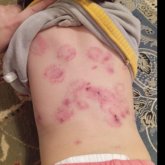 «Айғыр талағандай»: Балабақшада кішкентай бүлдіршінді 25 рет тістеген