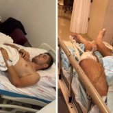 Түркияға демалуға барған қазақстандық ауыр жарақат алды