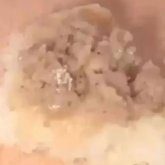 Жетісуда мектеп асханасындағы самсадан ақ құрттар шықты