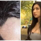 «Өз ақшама денемді бүлдіріп берді»: 22 жастағы қазақстандық қыз пластикадан кейінгі жағдайын айтты