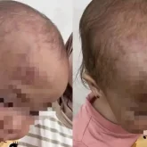 Ақтауда балабақшадағы бүлдіршіннің жарақаты жұртты шошытты