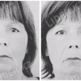 Петропавлда ауруханаға бет алған  зейнеткер аязға шыдамай үсіп қайтыс болды