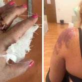 Жетісу облысында ер адам әйелді күрекпен аяусыз соққыға жықты