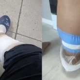 Көкшетауда жүкті әйелді  бір топ құтырған ит қауып алған