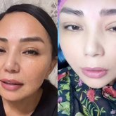 «Жіппен тігіп берді»: Алтынай Жорабаева ота жасатқанын айтты