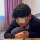 Таразда мектептегі төбелестен кейін жасөспірім бір көзінен айырылды
