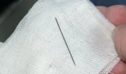 Түркістанда 8 айлық сәбидің ішінен ине табылды