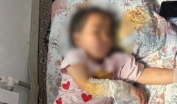 Түркістан облысында 4 жасар қызды шибөрі талап тастаған