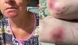 Тараздағы жаға ұстатарлық оқиға: Белгісіз біреулер әйелді азаптап, темекімен күйдірген