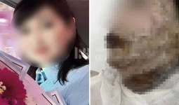 «Мен сені адам танымастай қылып тастаймын»: Бұрынғы әйелінің бетіне қышқыл шашқан күдікті ұсталды