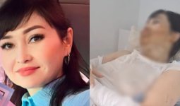 Шымкентте бұрынғы күйеуі қышқыл шашқан әйел алғаш рет болған жағдайды айтты