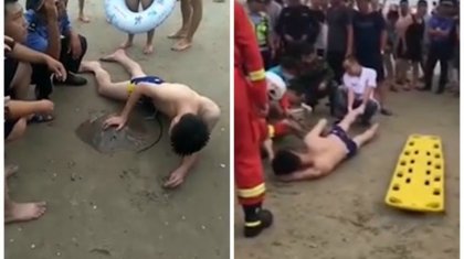 Жігіттің әуретті жеріне скат балығы жармасып алды