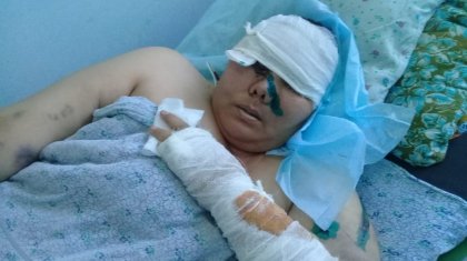 «Өлтіремнен басқаны айтпайды»: түркістандық азамат әйелін балталап тастады