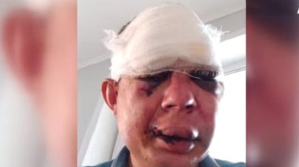 СҚО-да кен орнының қожайындары төбелесіп, 10 адам жарақаттанып қалды