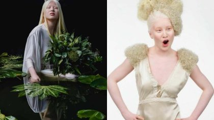 «Түрінен қорқып, тастап кеткен»: Ата-анасы бас тартқан альбинос-қыз танымал сән журналына шықты